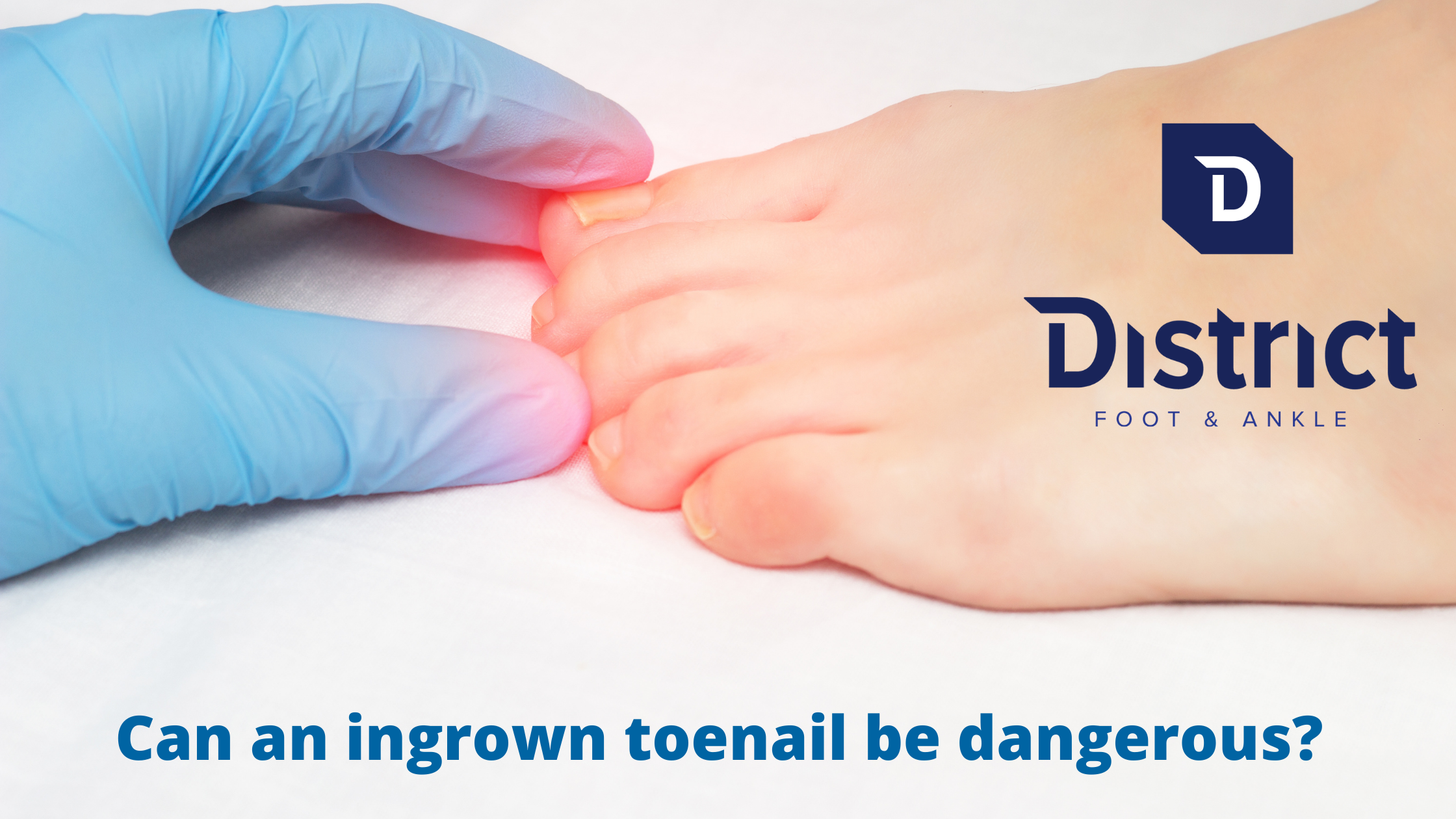 Can an ingrown toenail be dangerous?
