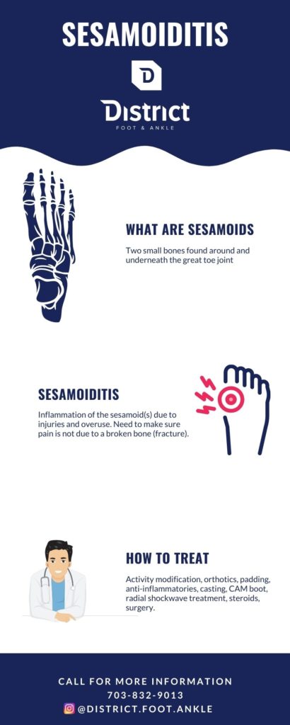 Sesamoiditis is a painful condition in which the two small bones around the big toe joint become inflammed
